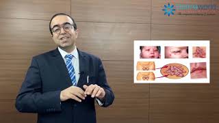 Herpes genital  causes symptoms diagnosis treatment  Dr Rohit Batra  In English [upl. by Eicram]