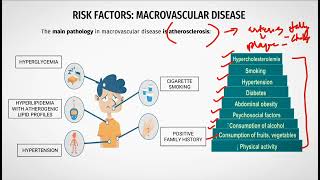 Macrovascular Complications Diabetes StrokeCVA CADPAD [upl. by Eirelav]