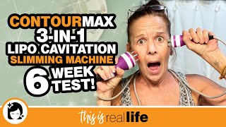 ContourMax 3in1 Lipo Cavitation Slimming Machine 6 Week Test  THIS IS REAL LIFE [upl. by Benjie]