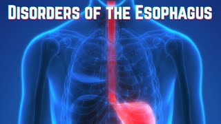 Disorders of the Esophagus updated 2023  CRASH Medical Review Series [upl. by Enelyam]