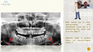 Digital Dental Radiology  uncovering the mystery [upl. by Laertnom]