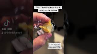 implantation de valve aortique par voie percutanéeTAVI  Transcatheter Aortic Valve Implantation [upl. by Sturdivant]