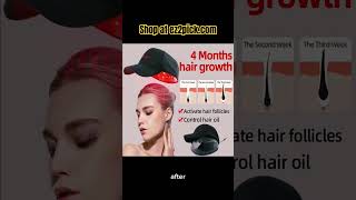 Boost Hair Growth Advanced Laser Cap Technology” HairGrowth LaserTherapy [upl. by Koal510]