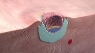 Implantation of the blastocyst [upl. by Trawets547]