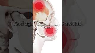 Temporalis Muscle Trigger Points [upl. by Yttik]