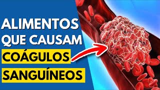 7 piores alimentos que causam coágulos sanguíneos [upl. by Rol]