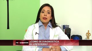 ¿Qué es y por qué sucede el linfedema [upl. by Ninaj]