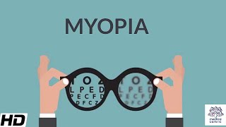 Myopia Signs and Symptoms Causes Diagnosis and Treatment [upl. by Neelrihs]