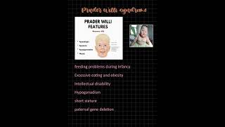 PRADER WILLI SYNDROME MNEMONIC fmge study MBBS [upl. by Tisdale]