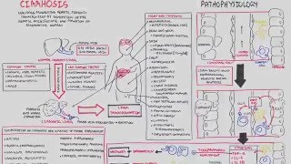 Liver Cirrhosis SandS Pathophysiology Investigations Management [upl. by Henriques]