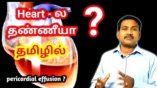 Pericardial Effusion in tamil  Heart Problem in tamil  ECG ECHO in tamil [upl. by Sedrul]