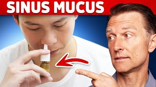 The 1 Remedy for Sinus Mucus  Pressure  Postnasal Drip [upl. by Ardnossak]