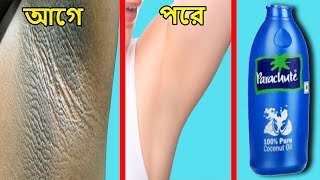 নিশ্চিত বগলের কালো দাগ দূর হবেই  Dark Underarms ফর্সা করুন  bogoler kalo dag dur korar upay [upl. by Bohon627]