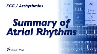 ECG 51  Summary of Atrial Rhythms [upl. by Missie538]