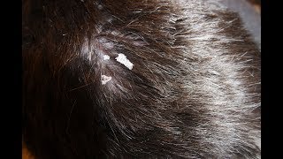 Removing dandruff with a toothpick [upl. by Brendin]