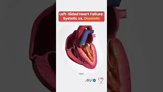 Systolic vs Diastolic Heart Failure 🫀 [upl. by Cornia422]