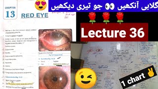 🔴 Clinical ophthalmology lectures 36 Red eye 👁‍🗨 causes of red Eye cornea conjunctiva sclera [upl. by Blase]