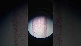 Microscopic practical of Mitosis ProphaseMetaphaseAnaphaseTelophase [upl. by Aikmat]