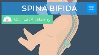 Spina bifida Causes classification prevention and treatment  Kenhub [upl. by Nagah]