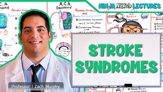 Stroke Syndromes MCA ACA ICA PCA Vertebrobasilar Artery Strokes  Pathophysiology [upl. by Sukramaj]