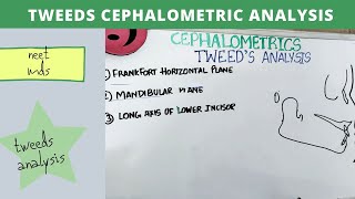 tweeds cephalometric analysis  orthodontics lecture notes [upl. by Renaldo426]