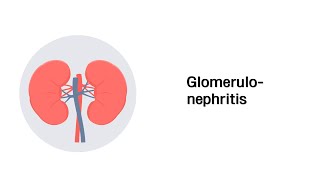 Glomerulonpehritis  Erkrankungen der Niere [upl. by Paulsen]