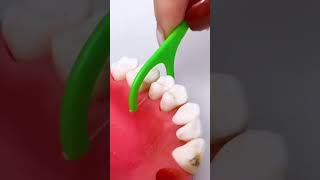 Best tool for teeth shortsvideo [upl. by Axela]