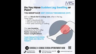 Your Leg Swelling Might be Deep Venous Thrombosis [upl. by Mazman891]