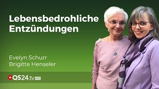 Warum Entzündungen oft lebensbedrohlich werden  Erfahrungsmedizin  QS24 Gesundheitsfernsehen [upl. by Pretrice751]