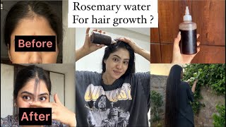 Best Lost hair regrowth remedy 😱 visible results with proof [upl. by Lynn237]