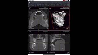 How to upload your CBCT DICOM files and how to use the Medical Viewer in SmileFy [upl. by Michelle818]