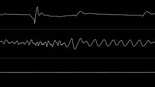 TBB  “0N0” C64 Oscilloscope View [upl. by Inail]