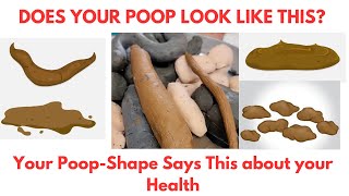 Does Your POOP Look Like This What your Poop Says about your Health [upl. by Ehsrop]