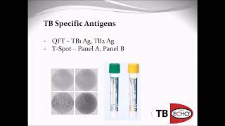 QFT and T SPOT TB Tests What do the numbers mean [upl. by Eecyac867]