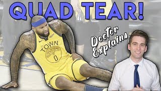 DeMarcus Cousins QUAD TEAR  Doctors ULTIMATE Guide [upl. by Zeralda]