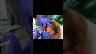 11 Lines Botox  Botox Injection For Glabella And Forehead shorts [upl. by Ambrosi19]