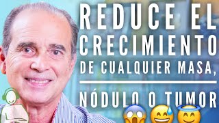 Reduce El Crecimiento De Cualquier Masa Nódulo O Tumor  Pregúntale A Frank 11 [upl. by Dilisio895]