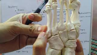 Jones Fracture  Everything You Need To Know  Dr Nabil Ebraheim [upl. by Gundry]