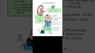 Glomerulonephritis renal nclexreview nclex [upl. by Ragde]