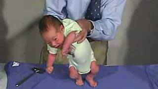 physical exam Newborn Normal Primitive Reflexes  Stepping [upl. by Tayler]