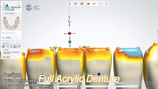 lucitone 199 full denture acrylic teeth heat curing acrylic complete denture [upl. by Innoj]