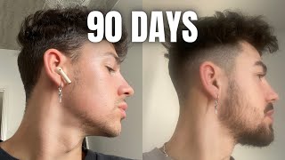 How To GROW A BEARD In 90 Days Using MINOXIDIL amp DERMA ROLLER [upl. by Ettezoj]