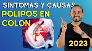 Pólipos Síntomas Causas Diagnostico y Tratamiento  Dr Juan Pablo Hernández Parte 1 [upl. by Truitt]