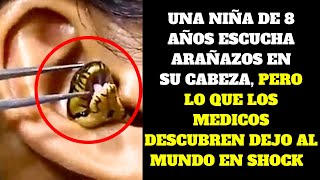 Niña De 8 Años Oye Arañazos En Su Cabeza Lo Que Descubren Los Médicos Te Producirá Escalofrios [upl. by Thedric]