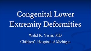 Congenital Lower Extremity Deformities  Dr Yassir [upl. by Iggy138]