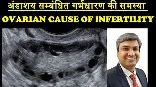 अंडाशय सम्बंधित गर्भधारण की समस्या  OVARIAN CAUSE OF INFERTILITY [upl. by Tombaugh]