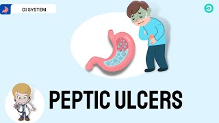 Peptic Ulcer Disease Everything you need to know [upl. by Saisoj]