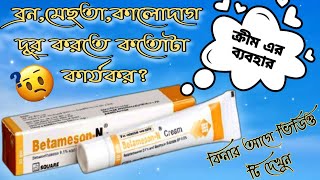 BetamesonN creamবেটামেসনএন এর কাজ কী এবং এর ব্যবহার জানুনত্বকের উজ্জ্বলতা বৃদ্ধিতে সত্যি কাজ করে [upl. by Bat644]