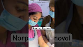 Norplant Removal — Full video click above👆🏻 contraceptives birthcontrol norplant shorts [upl. by Esinyt327]