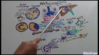 NETosis in COVID19 and chronic liver diseases [upl. by Madlin918]